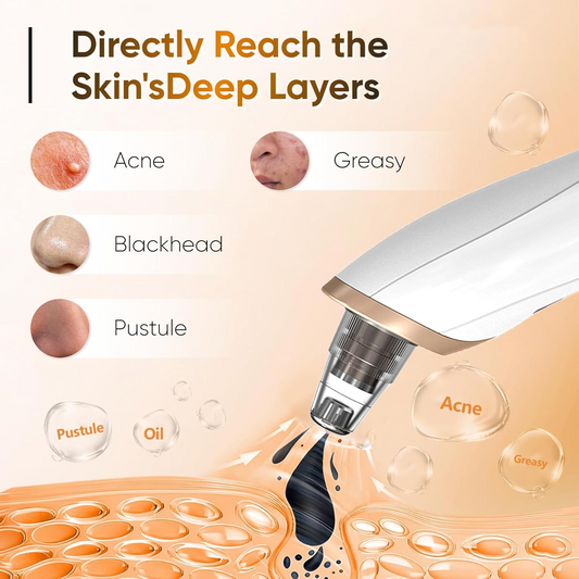 5 in 1 Rechargeable Blackhead Remover Facial Pore Cleaner Deep Cleaning